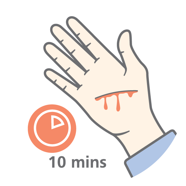 Illustration of a hand with a cut on it, from which some blood comes out. On the left, a timer with the text "10 mins"