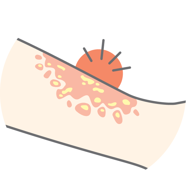 Illustration of an arm with some red spots on it, and a red circle with lines to indicate pain or itching