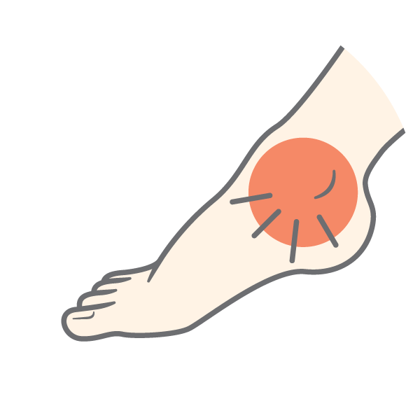 Illustration of an ankle with a red circle and lines to indicate pain